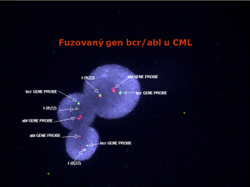 Fuzovaný gen bcr/abl u CML